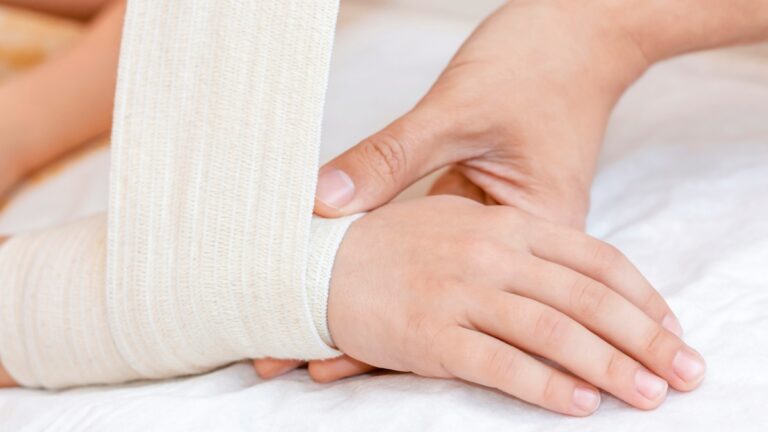 How Do I Know If I Need Stitches?